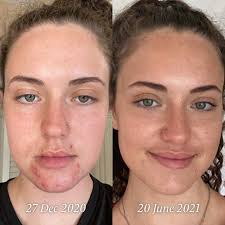 Glory Oil: Day & Night Oil