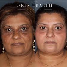 Whether you're a novice, or an expert 🎓 looking to elevate your skincare,  a solid, medical-grade routine will keep your largest organ looking and  feeling it's best 🙌🏻 . This patient saw