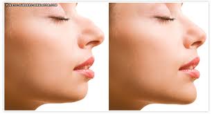 Mohs surgery and skin cancer reconstruction. Virtual Plastic Surgery Simulator
