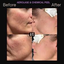 Kaitlynn Bray Aesthetics & Laser