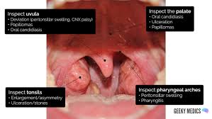 Image result for Submandibular Exam
