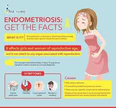 We did not find results for: Pin On Endometriosis