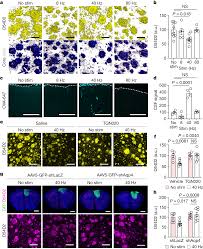Multisensory gamma stimulation promotes glymphatic clearance of amyloid |  Nature