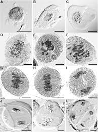 Lepro, awesome experience, satisfied price Meiocapture An Efficient Method For Staging And Isolation Of Meiocytes In The Prophase I Sub Stages Of Meiosis In Wheat Bmc Plant Biology Full Text