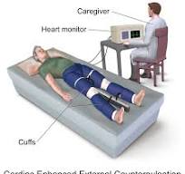 External counterpulsation - Wikipedia