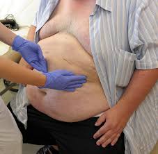 Klicken sie einfach auf das entsprechende organ um nähere informationen zu erhalten. Dad Bod Inneres Bauchfett Kann Gefahrlich Werden Welt