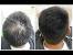 Regrow Hair Products