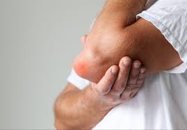 Image result for Bursitis