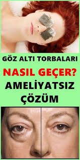 Goz Alti Torbalarina Ameliyatsiz Cozum Beauty Secrets Health And Beauty Beauty