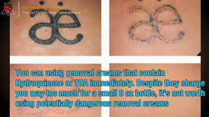 #2, wrecking balm tattoo removal system. Tattoo Removal Cream Reviews All You Must To Know About Tattoo Remove Youtube