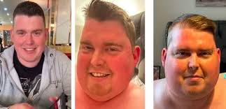 Doctors said my agonising symptom was stress