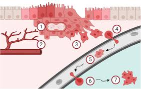 Maybe you would like to learn more about one of these? Frontiers The Role Of Proteoglycans In Cancer Metastasis And Circulating Tumor Cell Analysis Cell And Developmental Biology