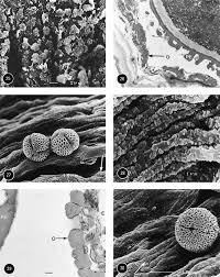 Image result for Calycosiphonia spathicalyx