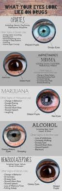 Whats Your Eyes Look Nursing Nursing Tips Nursing