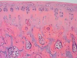 It contains no nerves or blood vessels, and its structure is relatively simple. Hyaline Cartilage An Overview Sciencedirect Topics