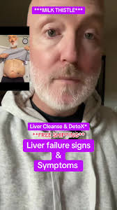 alcohol #cirrhosis #liver #fyp