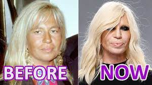 Her designs for versace may spark a thousand copycats, but there is no danger of women following suit when it comes to donatella versace's new look. Woman And Time Donatella Versace Before And After Youtube
