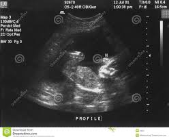 Ultra Som Do Bebe Foto De Stock Imagem De Vida Pouco Ultrassom 2464