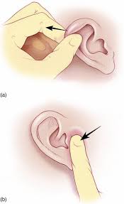It is a symptom triggered by a various if you experience tinnitus after you begin taking a new medication, contact the prescribing physician. Ear Pain Nosebleed And Throat Pain Ent Chapter 24 An Introduction To Clinical Emergency Medicine