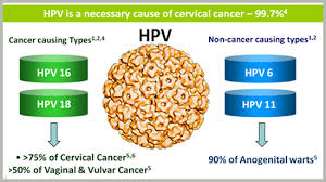 Still, if you have any of these symptoms, see a health care professional right away. Cervical Cancer Cause And Prevention