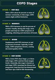 Copd Life Expectancy Stages And Prognosis Here Are Your Numbers
