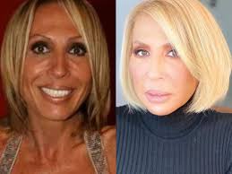 Tan atrevida como siempre, laura bozzo reafirmó su gusto por los jovencitos, pues recientemente confesó que por fin conoció a su crush, un joven cantante, que en palabras de ella, podría ser su nieto. Laura Bozzo Cambia Su Piel Por Uso De Botox Vea Como Luce