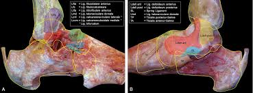 Oft stellt sich dann die frage, ob man zum arzt muss oder nicht. Schnell Umgeknickt Und Nun Bandverletzungen Am Sprunggelenk Und Ihre Behandlung Gesellschaft Fur Orthopadisch Traumatologische Sportmedizin Gots
