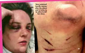 LEFT FOR DEAD ... BY HER BEST FRIEND!