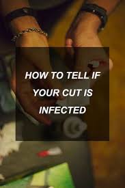 Mar 13, 2015 · the first sign of an infection is redness and swelling around the wound channel. Pin On Health