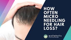 So, why not start treating balding people with dermabrasion on their heads? How Often Microneedling For Hair Loss
