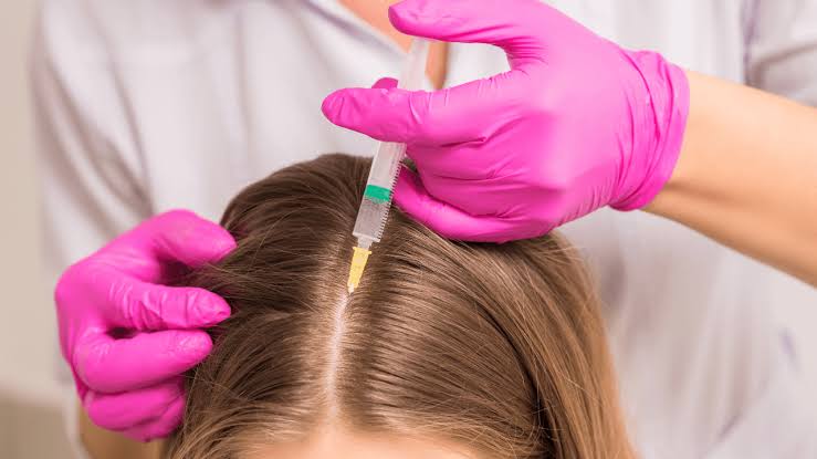 Exosome for Hair Loss in Dubai | Exosome Therapy for Hair Growth