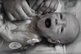 Die umgebung des kernkraftwerks wurde erst nach drei tagen evakuiert weitere referate | hausarbeit zu tschernobyl: 31 Jahre Spater Die Schreckliche Wahrheit Uber Die Folgen Von Tschernobyl