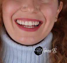 Güzel bir gülüş hayatınızda çok şey değiştirir.