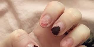 This is sealed into place. This Beauty Blogger Swears Biotin Brought Her Nails Back To Life Self