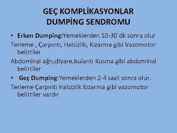 Seren serengil'in hastalığı olarak bilinen dumping sendromu, mide ameliyatları sonrasında görülen bir. Mide Anatomi Cardia Fundus Corpus Antrum