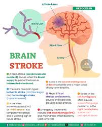 Bildergebnis für CVA