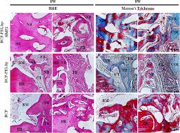 Transfiere hasta s/ 1,000 por transacción. A Study Of Bmp 2 Loaded Bipotential Electrolytic Complex Around A Biphasic Calcium Phosphate Derived Bcp Scaffold For Repair Of Large Segmental Bone Defect