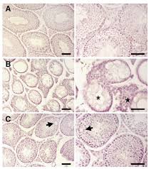 Activin a, a product of fetal leydig cells, is a unique paracrine regulator of sertoli cell proliferation and fetal testis cord expansion. Effect Of Liver Growth Factor On Both Testicular Regeneration And Recovery Of Spermatogenesis In Busulfan Treated Mice Reproductive Biology And Endocrinology Full Text