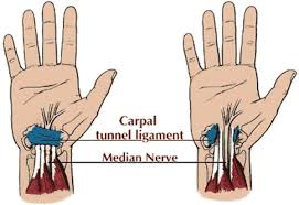 Dicas E Exercicios Para Aliviar Os Sintomas Da Sindrome Do Tunel Do Carpo Veja Agora Clique Na Imagem Tunel Do Carpo Dedos Da Mao Nervo Mediano
