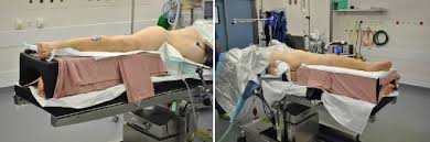 Common procedures performed in this position include procedures on the lung, aorta,. Direct Anterior Approach To The Hip Joint In The Lateral Decubitus Position For Joint Replacement Springerlink