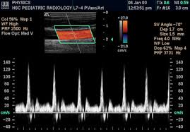 There are 3 components of a color doppler jet that make up the appearance we see on the screen. Doppler Ultrasonography Wikipedia