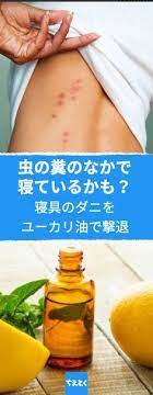 寝具のダニをユーカリ油で撃退 ダニ退治 ライフハック ユーカリオイル ユーカリ油 アロマ オイル 効果的 おすすめ 話題 人気 簡単 使い方 作り方 ヘルスケア 健康 diy ちえとく 健康 ユーカリ アロマ 虫除け 手作り