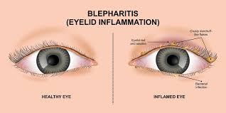 Image result for Blepharis gazensis