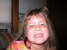 Child loses first tooth