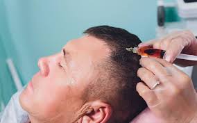 This thread is about eyebrow hair loss. Prp Hair Loss Treatment Toronto Prp Hair Restoration Experts