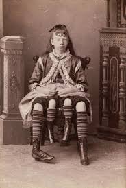 And she was known as the four legged woman. Josephine Myrtle Corbin 4 Shocking Facts About The 4 Legged Woman