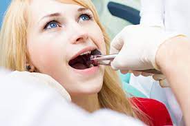 Once your tooth's extraction procedure has been completed, you'll no doubt want to know how long it will take for its socket to heal. Tooth Extractions Do S And Don Ts Aos