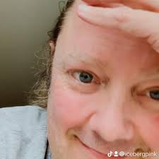 Arm and elbow braces for baseball pitchers