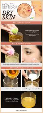 Home Remedies To Get Rid Of Dry Itchy Skin At Home Infographic Skin Remedies Dry Itchy Skin Skin Care Remedies