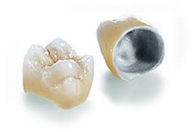 Welcome to pfm car & truck care. Dental Crowns Center Ceramics Pfm Crowns At Cosmetic Specialist